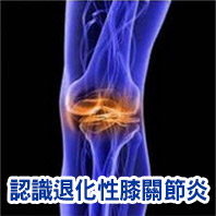  膝蓋關節疼痛 
